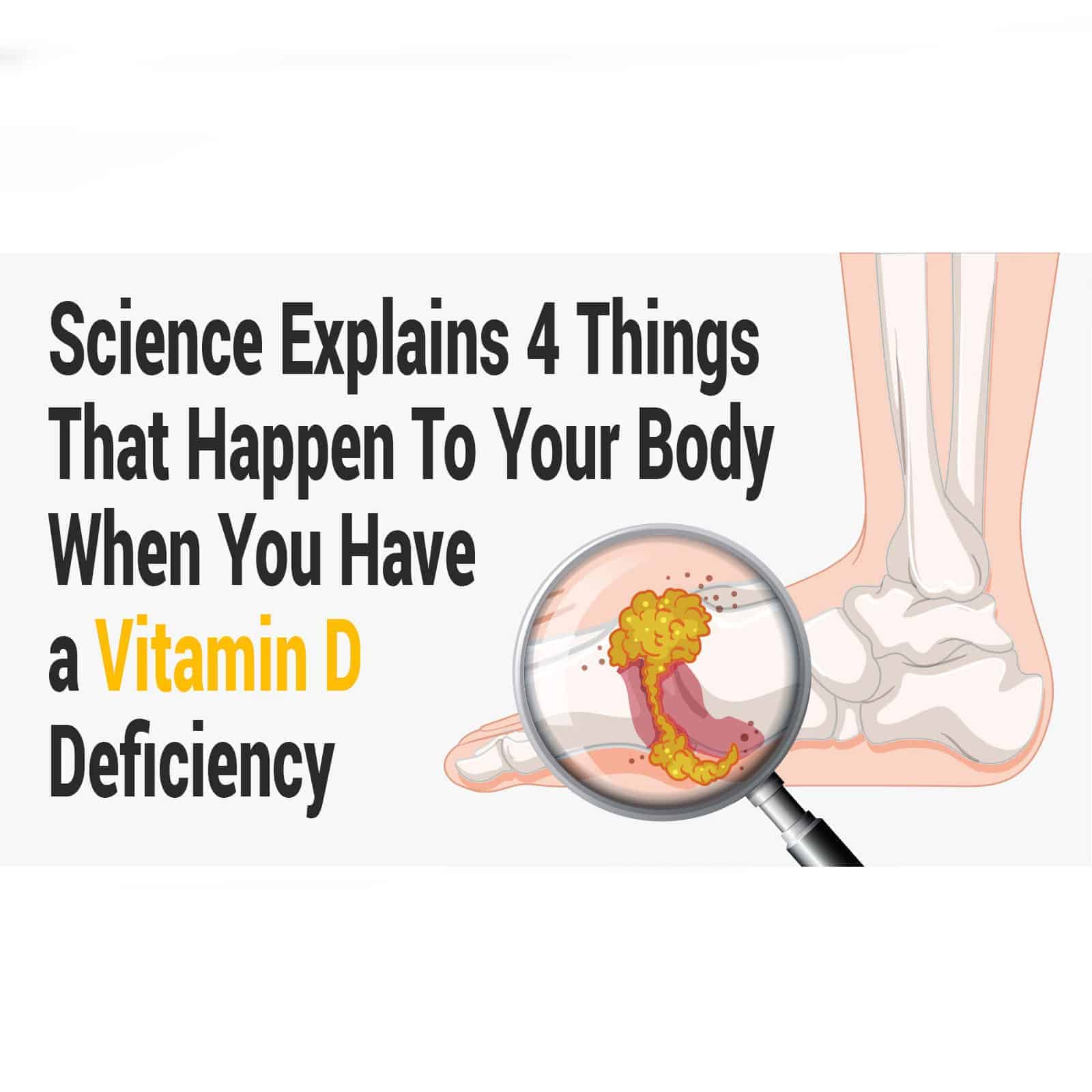 vitamin d deficiency