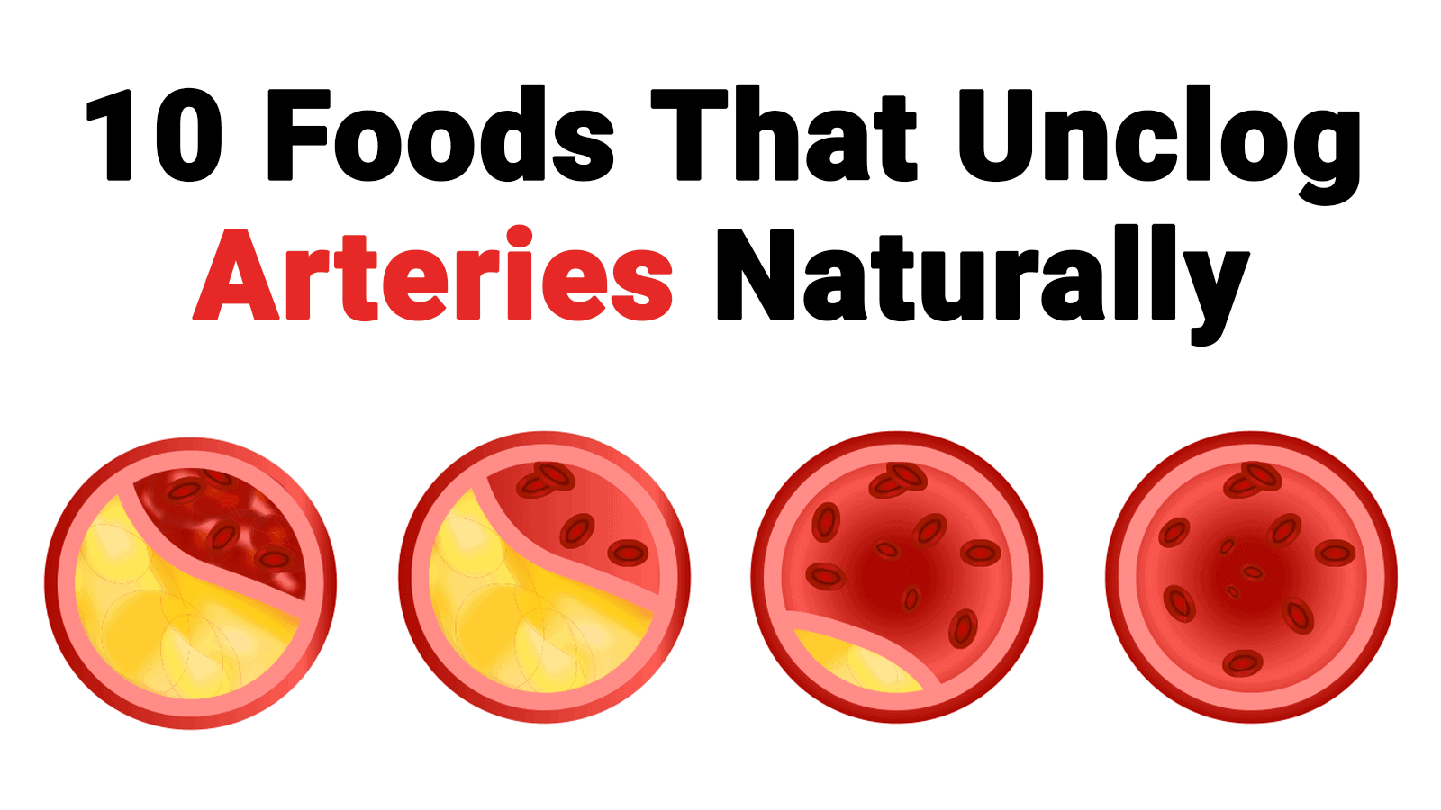 how high fiber foods unclog arteries
